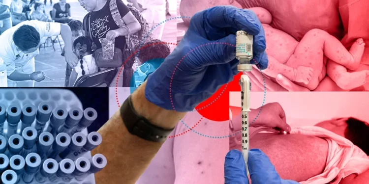 EN MÉXICO SE INCREMENTARÁ LA VACUNACIÓN POR SARAMPIÓN