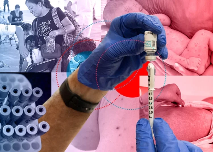 EN MÉXICO SE INCREMENTARÁ LA VACUNACIÓN POR SARAMPIÓN